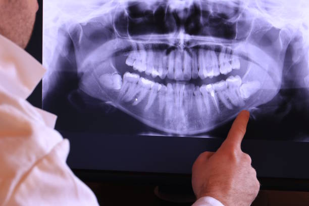Best Walk-In Emergency Dentist in Ennis, TX